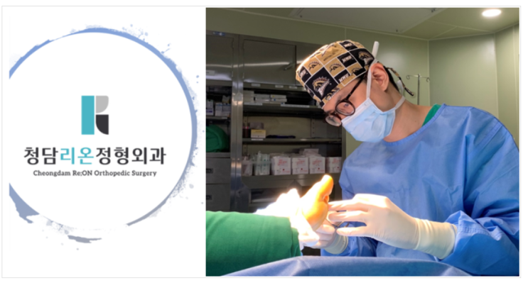  발목 인대 파열, 발목염좌(접질렀을때, 삐었을때?) 발목 불안정성(청담리온정형외과 김재우원장)