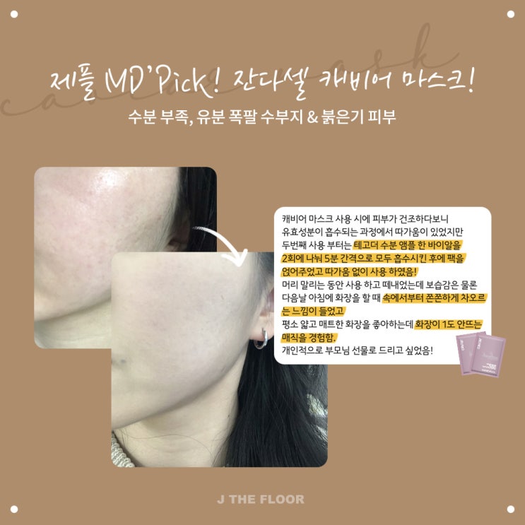  잔다셀 라인 곧 마감 ! / 탄력과 주름관리는 지금바로 제플에서 시작하세요 /