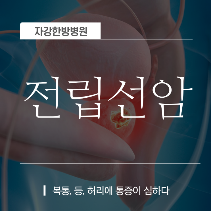  전립선암의 증상과 원인, 예방법, 그리고 '좋은음식'까지