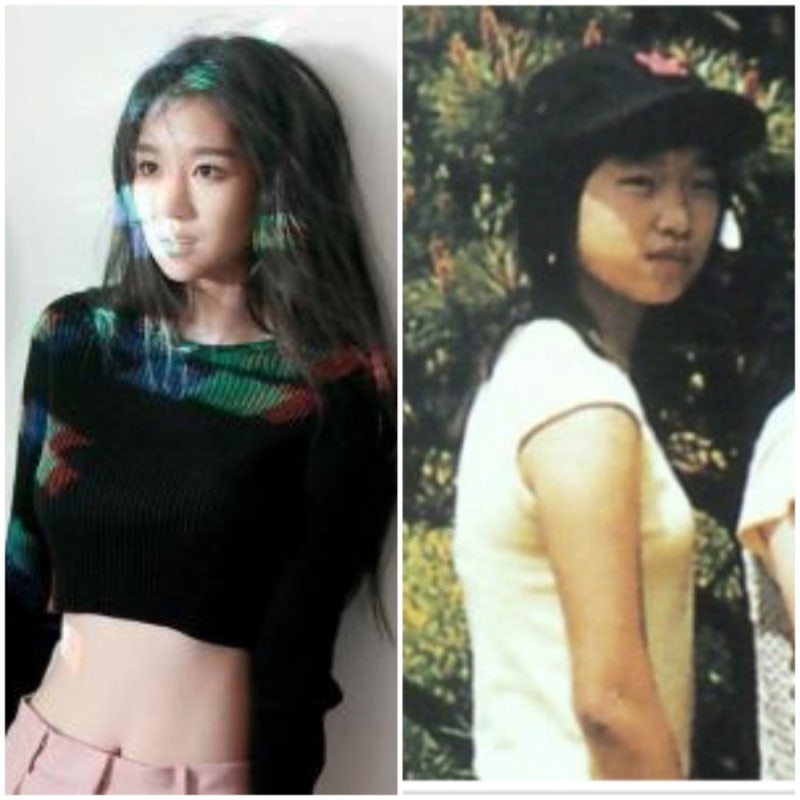 서예지 성형전, 중학생 졸업사진 때문에 망신 당한 성형외과 의사 나이 프로필 정리