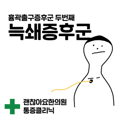 팔에 힘이 없어요. 팔이 저려요. 흉곽출구증후군 두 번째. 늑쇄증후군 (costoclavicular syndrome) 팔에 힘이 없어요. 팔이 저려요. 흉곽출구증후군 두 번째. 늑쇄증후군 (costoclavicular syndrome)