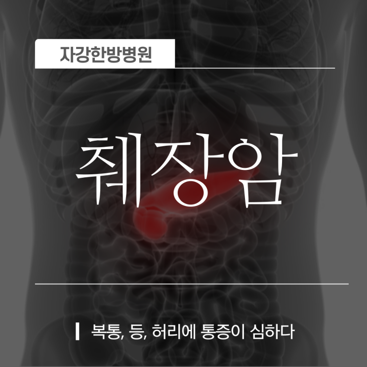 췌장암 초기증상, 등통증, 위험요인, 검사방법 및 치료법 좋은음식은?