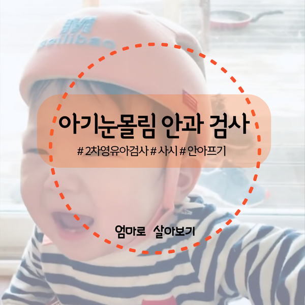  아기 눈몰림, 2차 영유아 검진 후 안과 검사