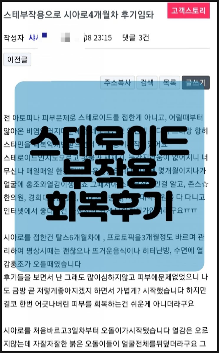  스테부작용으로 시아로 4개월차 후기입니다
