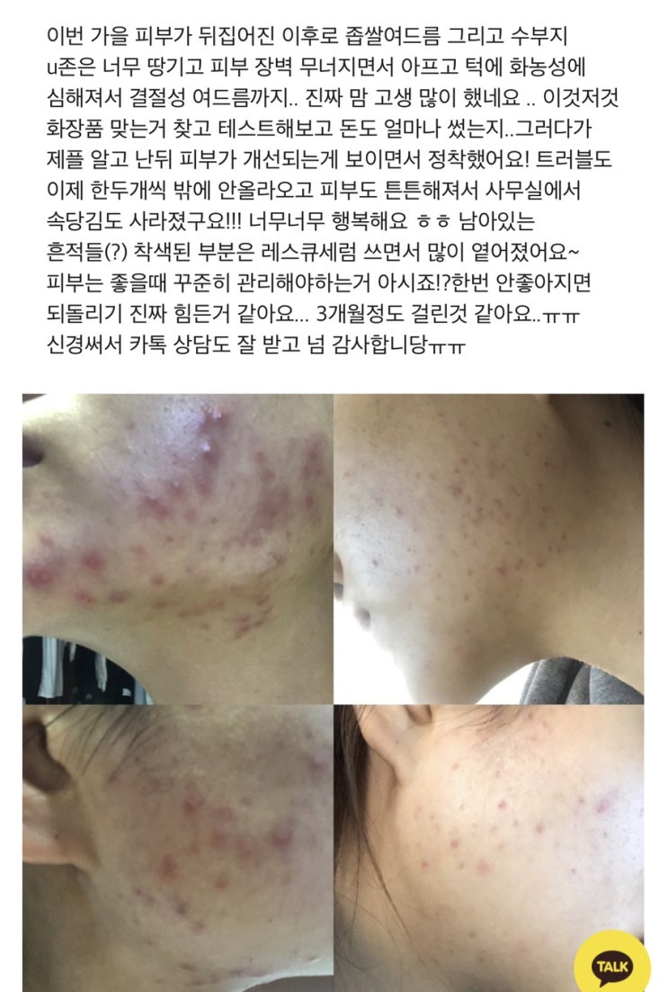 제리카 에센스 수량 4000개 중 절반 소진 ! 현재 이유있는 주문 폭주 !