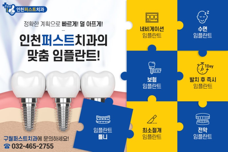 임플란트 수명을 늘리는 20년 경험의 인천터미널역치과의 노하우
