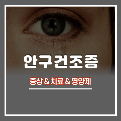 안구건조증 증상 및 치료방법 : 권장하는 안구건조증 영양제