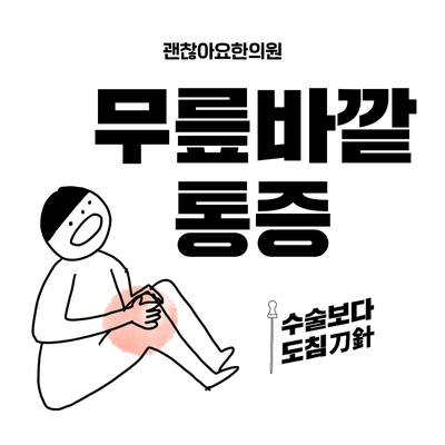  무릎 바깥쪽 통증, 장경인대증후군, 도침치료