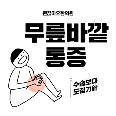 무릎 바깥쪽 통증, 장경인대증후군, 도침치료