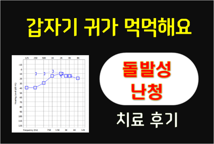 "갑자기 귀가 먹먹해요" 24세 남성 - 돌발성난청 치료후기