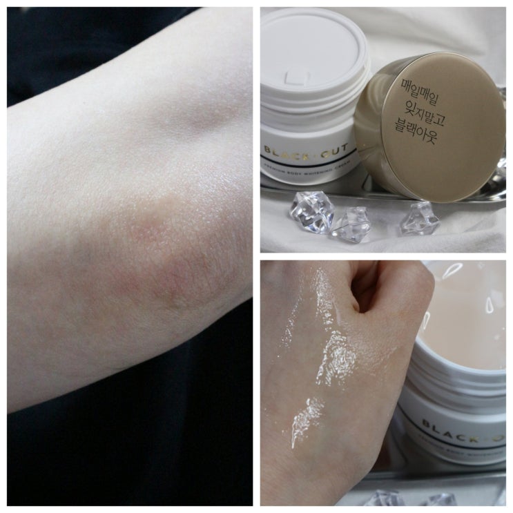 팔꿈치 색소침착 : 뷰티영 블랙아웃 프리미엄 바디 미백크림 바디톤업크림 으로 한 톤업 팔꿈치 색소침착 : 뷰티영 블랙아웃 프리미엄 바디 미백크림 바디톤업크림 으로 한 톤업