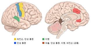 신경계 특수검사 뇌파 MRI 근전도 결과해석 목적합병증 준비간호중재