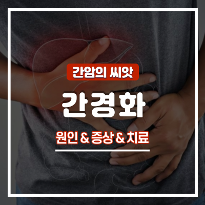  간암의 씨앗, 간경화(간경변) 초기증상 및 치료법 : 말기증상 예방법