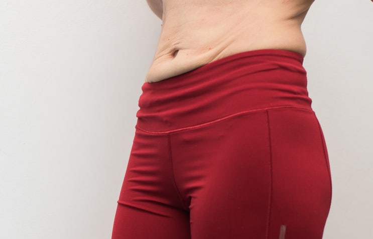  뱃살 슈링크 리프팅? 광고글에 지치신 분들은 보세요.