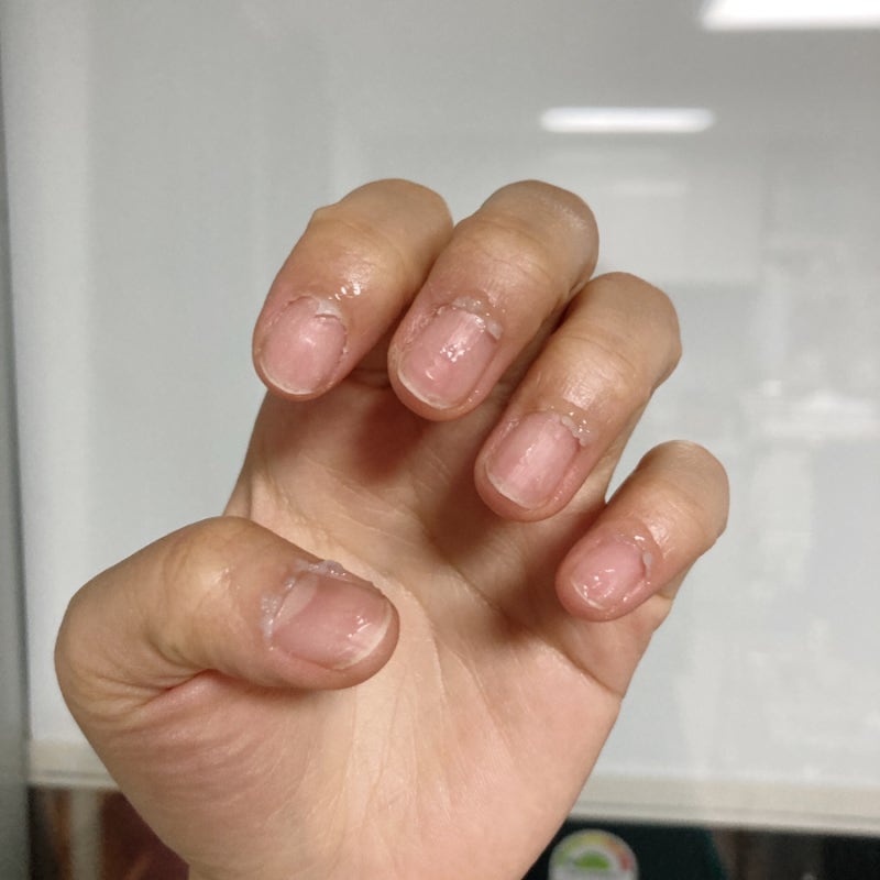 인스턴트 큐티클 리무버 올리브영 큐티클 리무버 (똥손 큐티클 제거 후기)