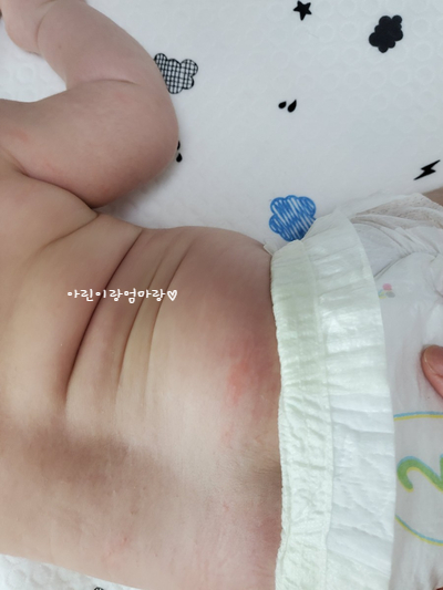 88일차-등센서, 아벤트 울트라 소프트, 책 넘기기, 아기땀띠 88일차-등센서, 아벤트 울트라 소프트, 책 넘기기, 아기땀띠