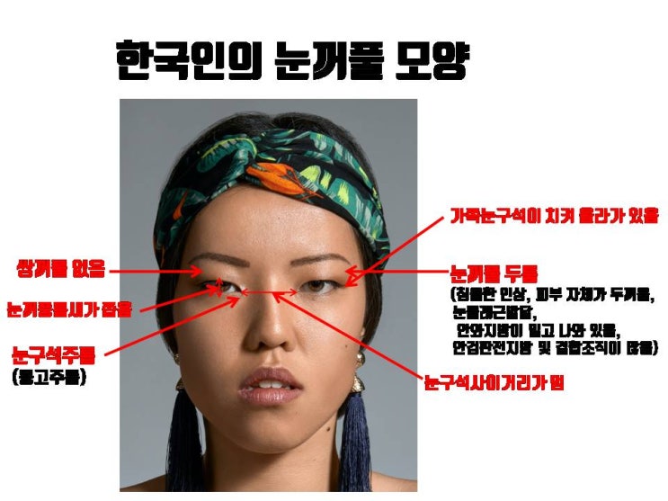  한국인의 눈꺼풀은 쌍꺼풀 없고, 몽고주름 심하고, 눈두덩이살 많고 눈꼬리 올라간 것이 정상이에요!!!