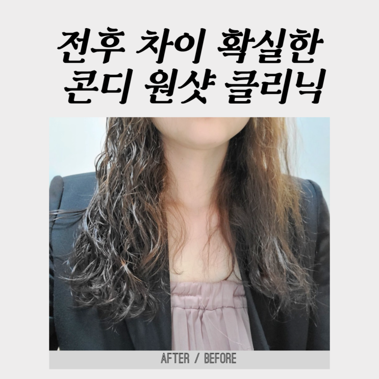  콘디몰 콘디원샷 헤어클리닉