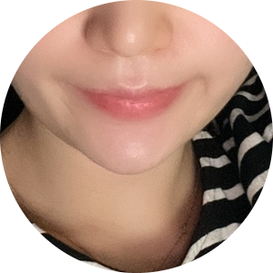  각진 네모 무턱 자갈턱 보톡스 턱필러 리얼 찐후기: 드디어 예쁜 얼굴형 찾음