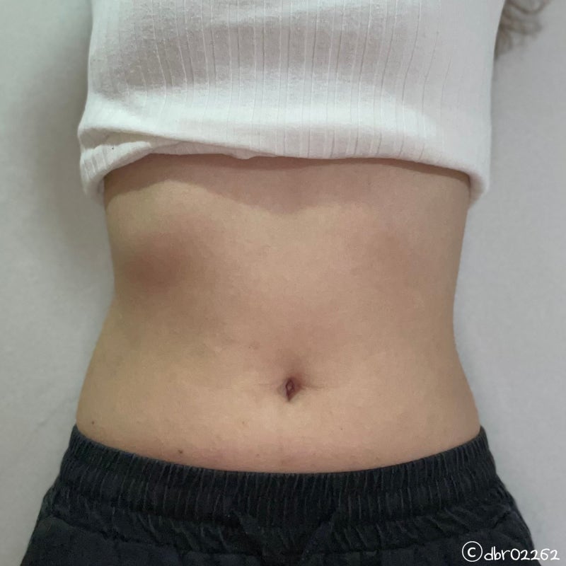 [대구/동성로] MPL주사 솔직히 후기 3주차