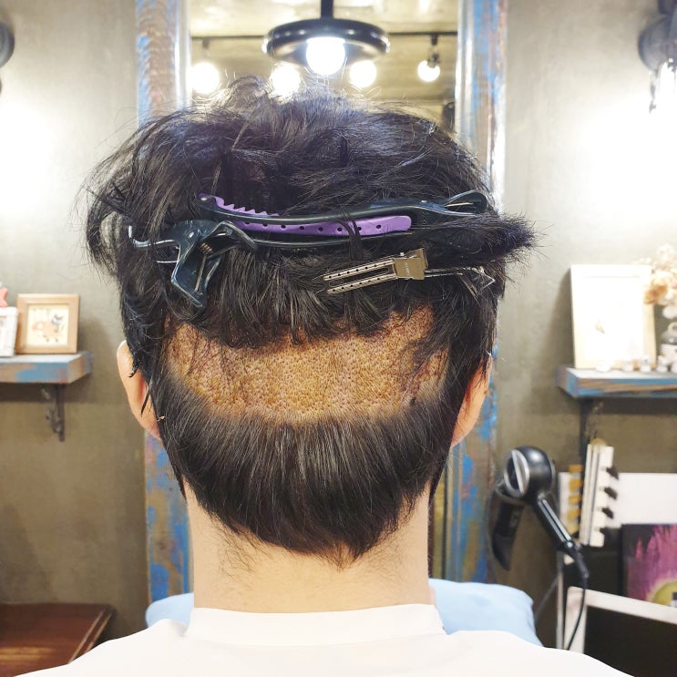  탈모 파마 해도 될까요?