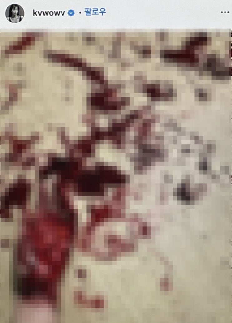 권민아 인스타그램에 간호사 저격한 이유 손목 자해 사진 충격적 정신병원 이미 10년 넘게 다녔다는데...