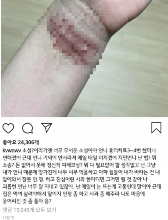 ê¶Œë¯¼ì•„ ë˜ ìžì‚´ì‹œë„ ê¶Œë¯¼ì•„ ìží•´ ì´ì •ë¦¬ ì†ëª©ì‚¬ì§„í¬í•¨ ë„¤ì´ë²„ ë¸