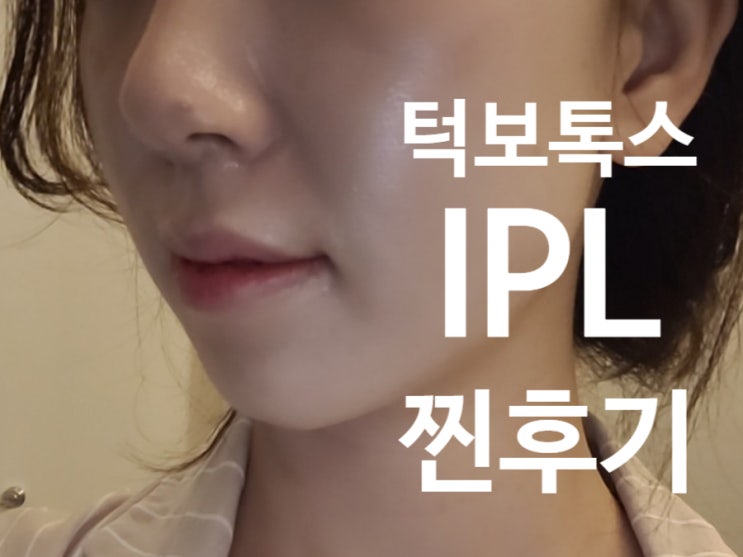  대전보톡스 IPL레이저 유성성형외과에서 하고 왔어요