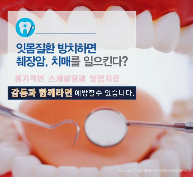 치아 관리를 제대로 못 하면 치매까지 걸린다는데 사실인가요?