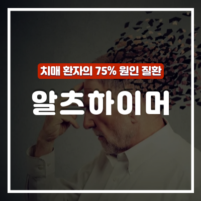  알츠하이머 원인 및 초기증상 10가지 : 효과적인 예방방법