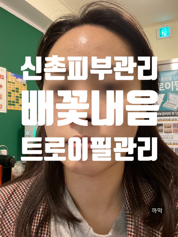 신촌피부관리, 배꽃내음 여드름피부 트로이필 관리후기