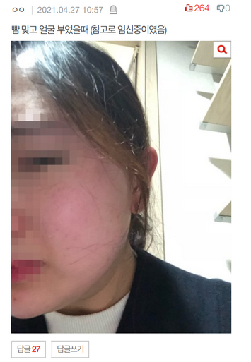 네이트판 대구 상간녀, 유치원, 신상, 얼굴 네이트판 대구 상간녀, 유치원, 신상, 얼굴