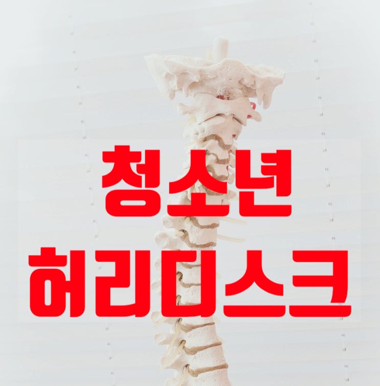  청소년 허리디스크 추간판탈출증 원인 치료 운동법 디스크석회