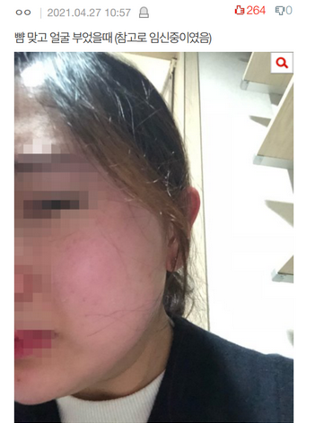 대구 상간녀 신상, 사진, 전남편 상황 대구 상간녀 신상, 사진, 전남편 상황