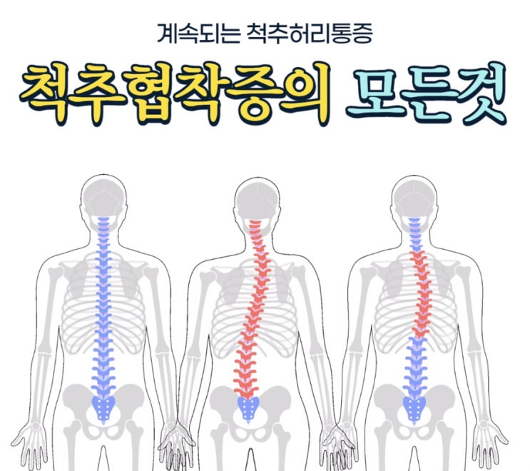  친한의원: 오공약침의 진통효과