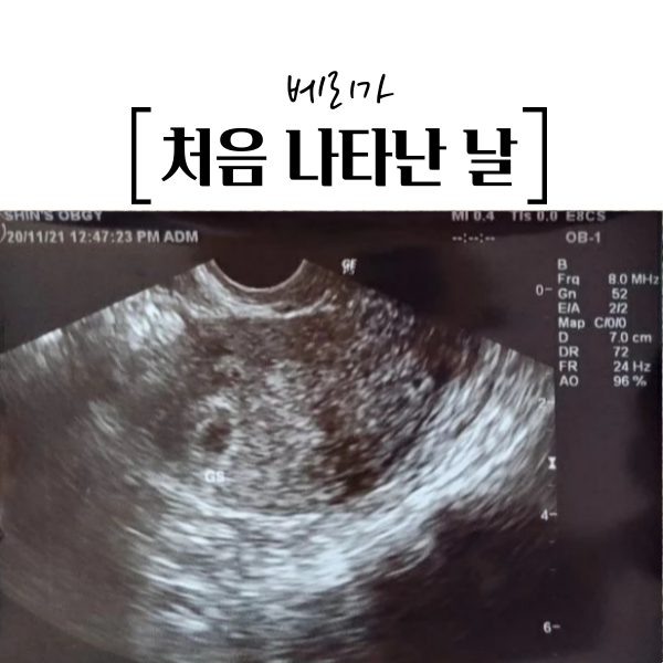  베리가 처음 나타난 날.