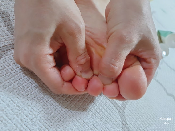  임산부 발 마사지젤 바른생각 스탠다드 엑스트라케어 차이점