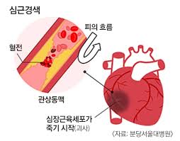 항부정맥약물정리 리도카인 인데랄 칼슘통로차단제 aminodarone 효능부작용 용량투약경로