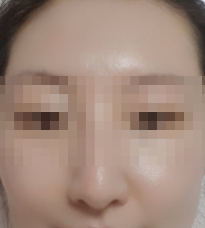  [르네셀] 다이아몬드필 2회차 2일째 후기