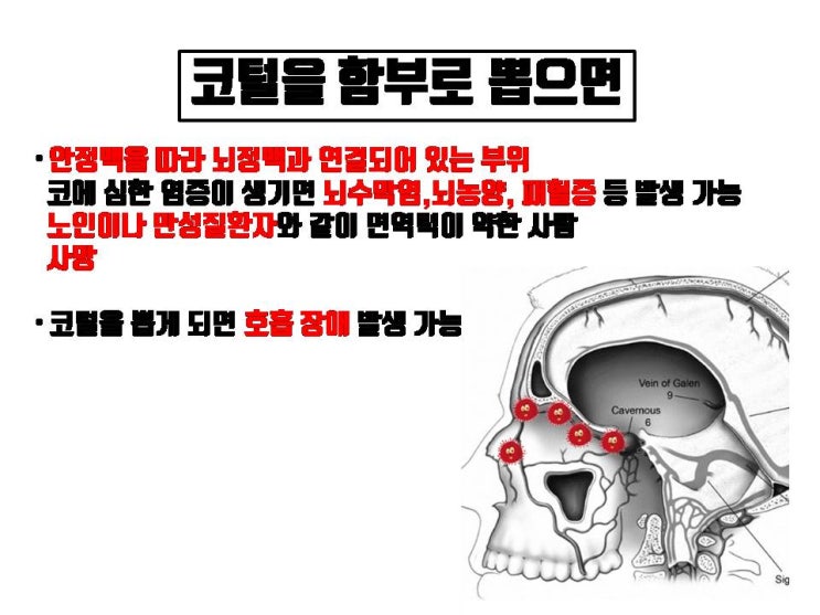  코수술 후 함부로 코털 뽑으면 코수술 염증으로 보형물 제거해야 될 수 있어요!!!