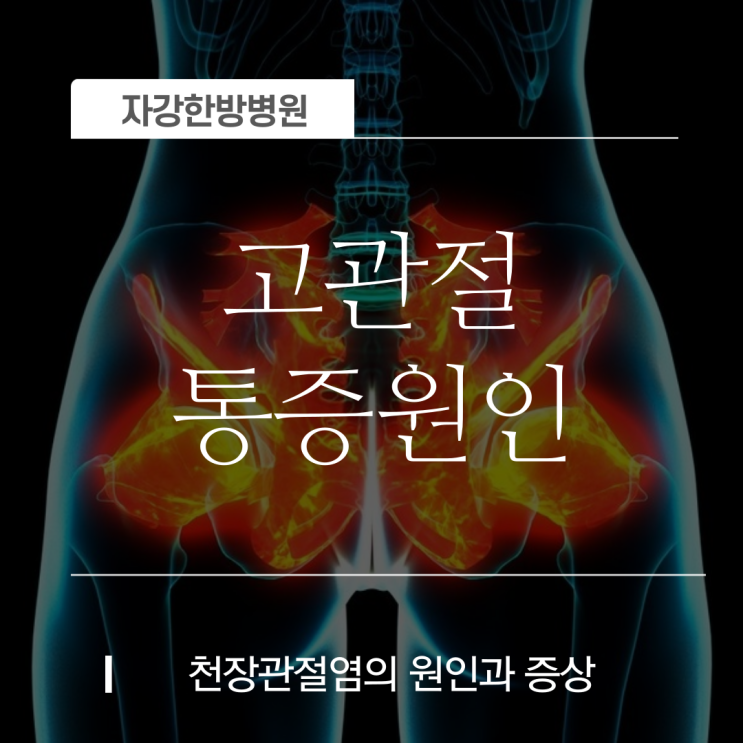  천장 관절염의 원인과 증상 고관절의 통증 원인 총정리!