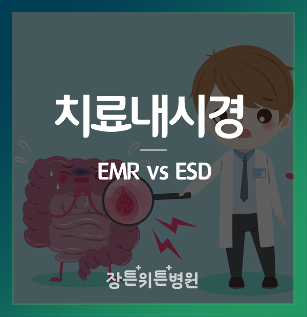 치료내시경 EMR, ESD 차이점