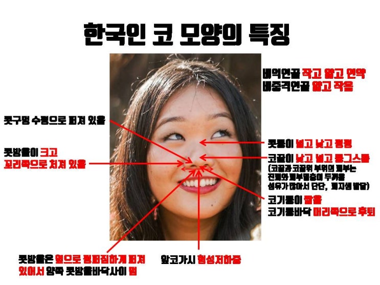  한국인의 코모양은 원래 낮은 콧대, 복코, 넓은 콧볼을 특징으로 해요 ㅠㅠ