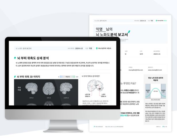  인공지능 기반 퇴행성 뇌질환 진단 보조 소프트웨어[AQUA]