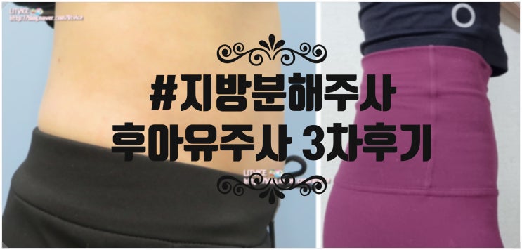  지방분해주사 후아유주사로 아랫배 빼는법 후기 3차(비포에프터사진O)
