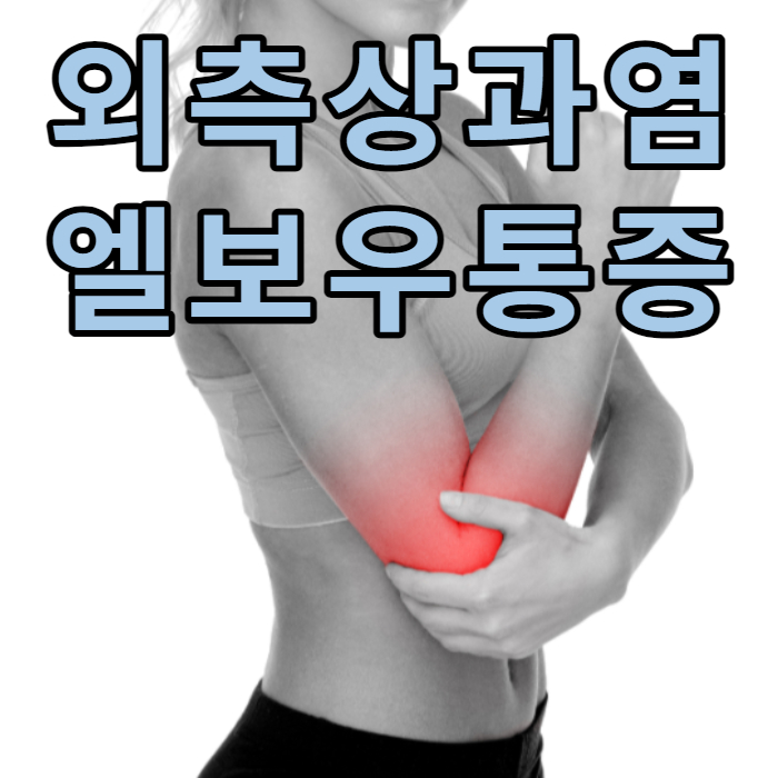  주관절 외상과염 외측상과염 elbow 테니스엘보 팔꿈치 통증 운동 치료 예방법