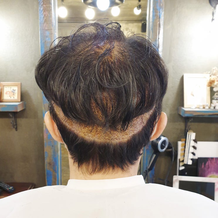  남자 가르마펌 m자 탈모 가릴 수 있나요?