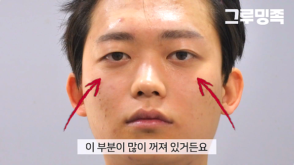  남자눈밑주름? 후기 보고 갔다가 후회하는 고객 특징