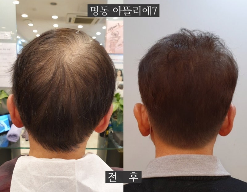 중년남성헤어스타일 스캘프컷 볼륨펌으로 중년미 찾아드립니다~ 3