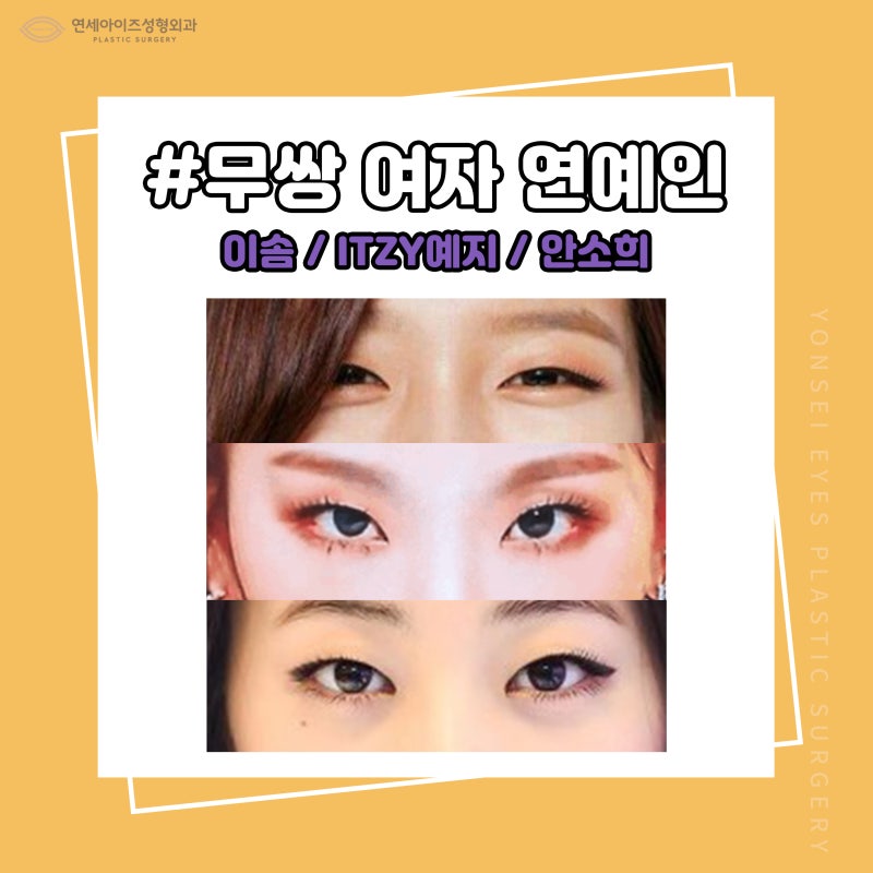 쌍꺼풀 없이도 눈 예쁜 무쌍 속쌍 여자연예인과 인아웃라인 아웃라인 쌍꺼풀 연예인 분석 (연세아이즈성형외과) : 네이버 블로그